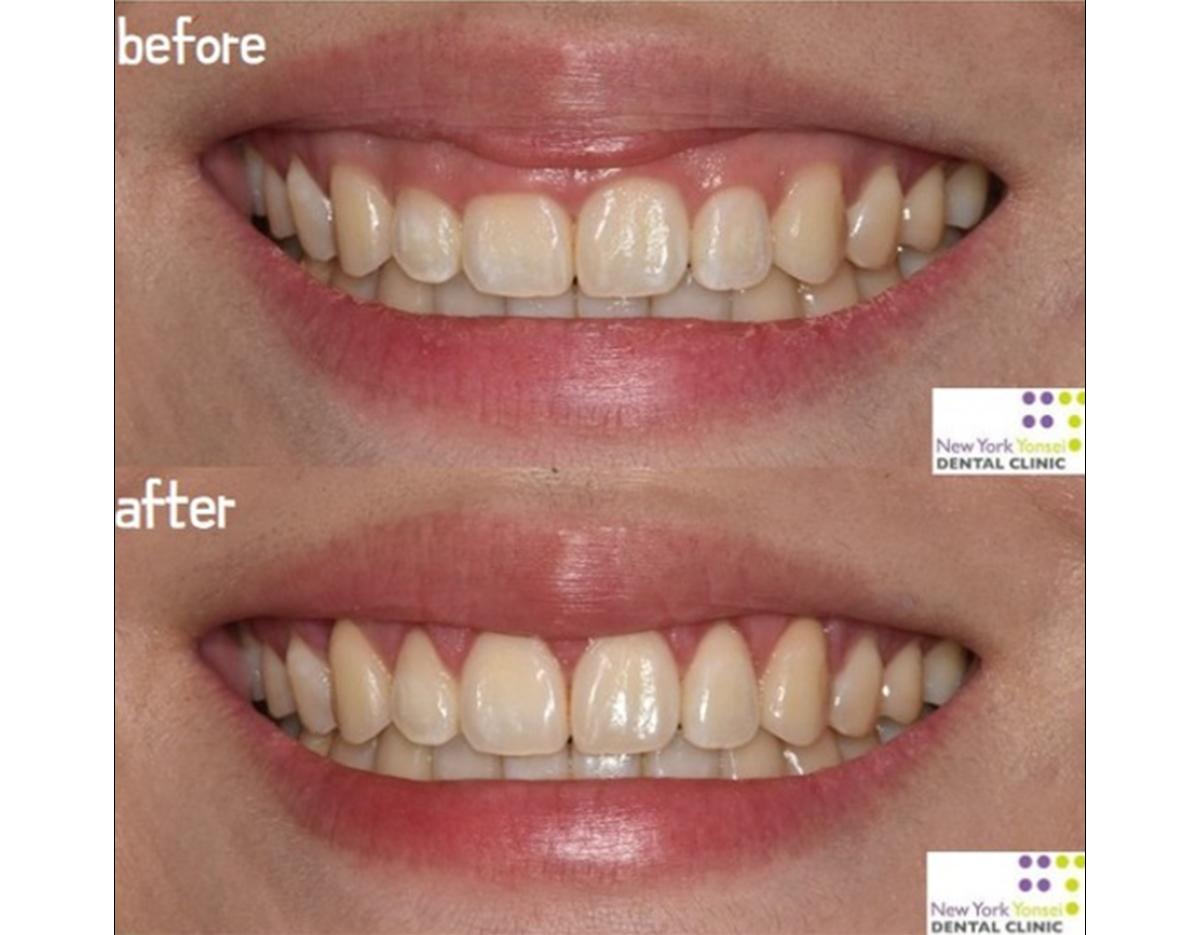 New York Yonsei Dental Clinic