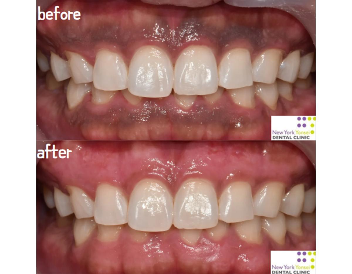 New York Yonsei Dental Clinic