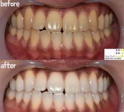 Clinica odontoiatrica Yonsei di New York | Prenotazione gratuita