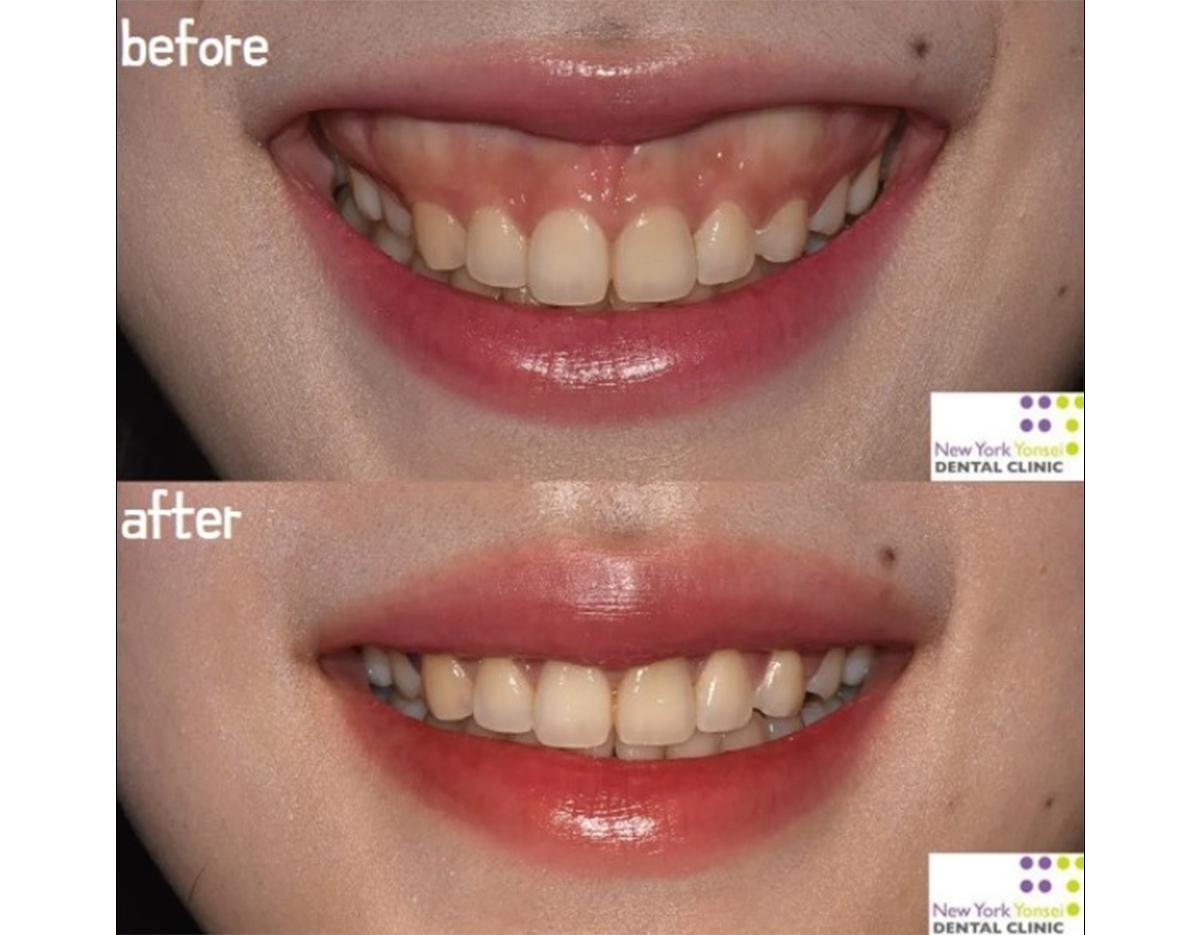 New York Yonsei Dental Clinic