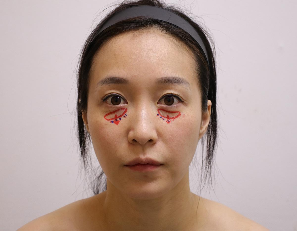 fresh hong doctor clinc