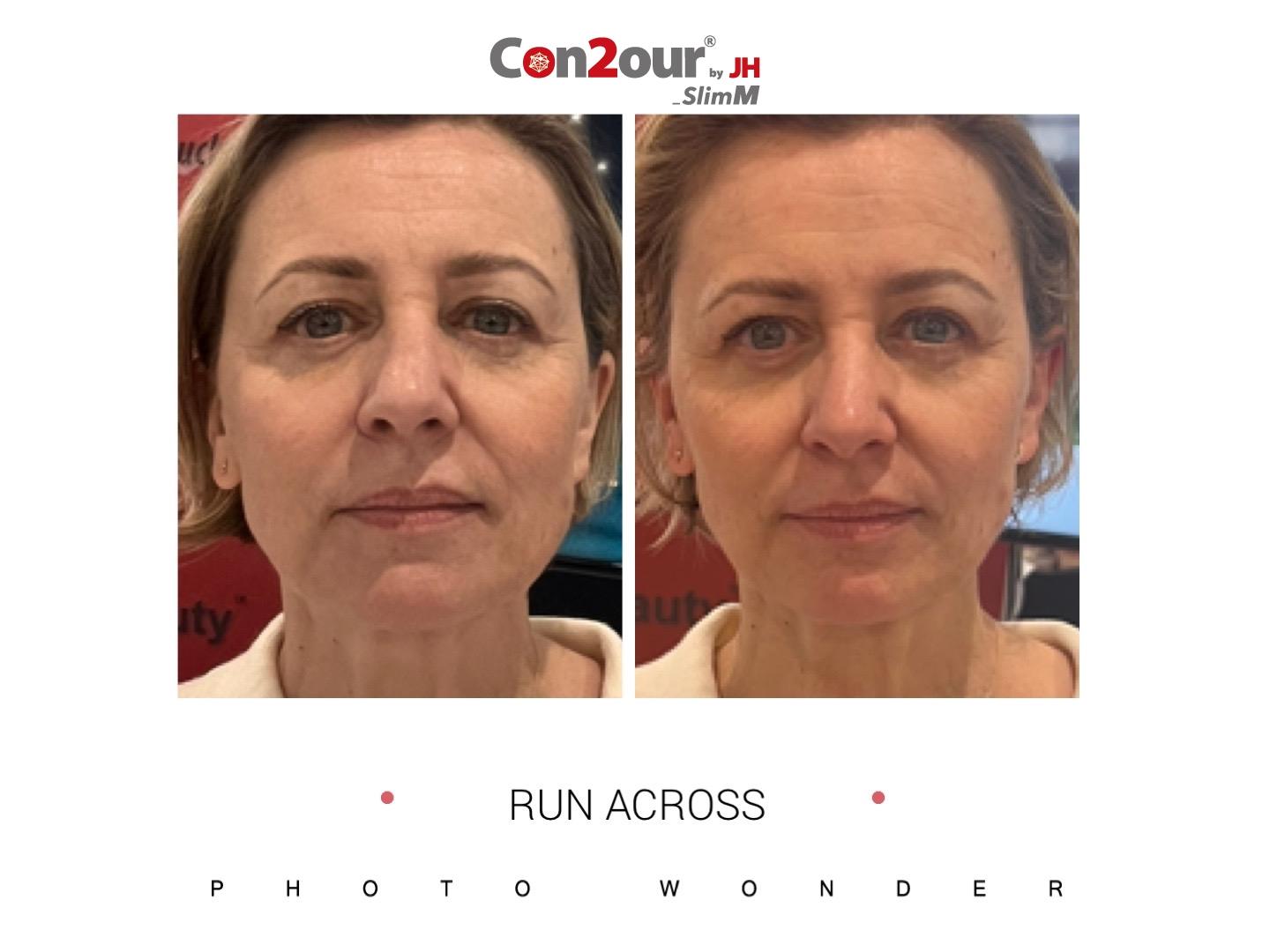 서울 슬림엠 본점(Con2our by JH SlimM)