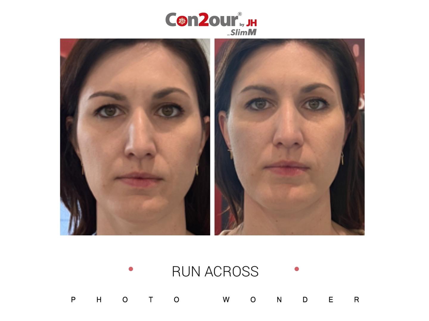 서울 슬림엠 본점(Con2our by JH SlimM)