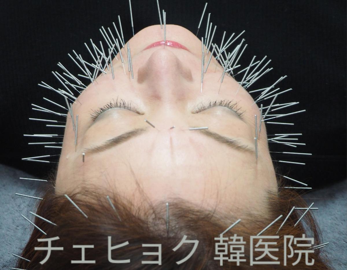 CHOI HYEOK KOREAN MEDICINE