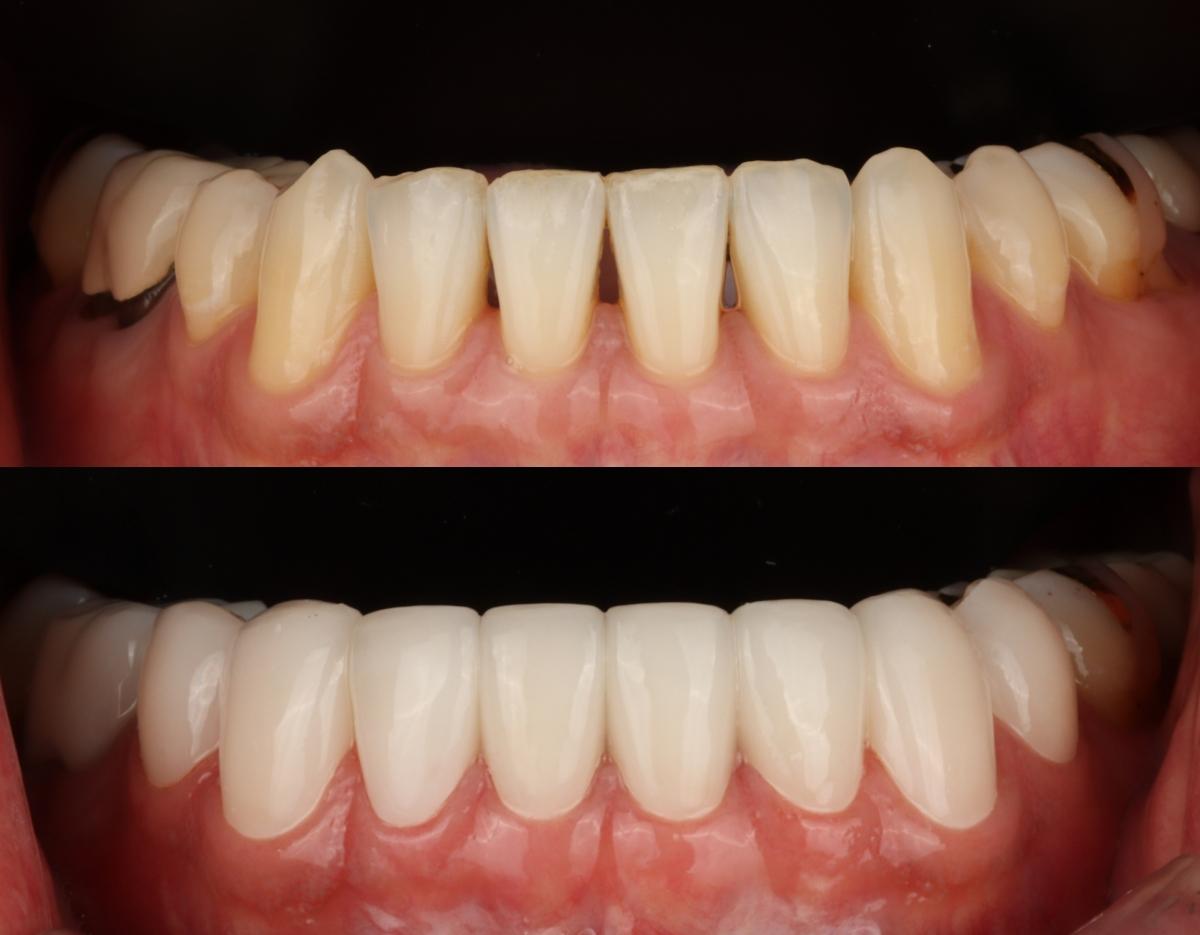 blanche dentalclinic