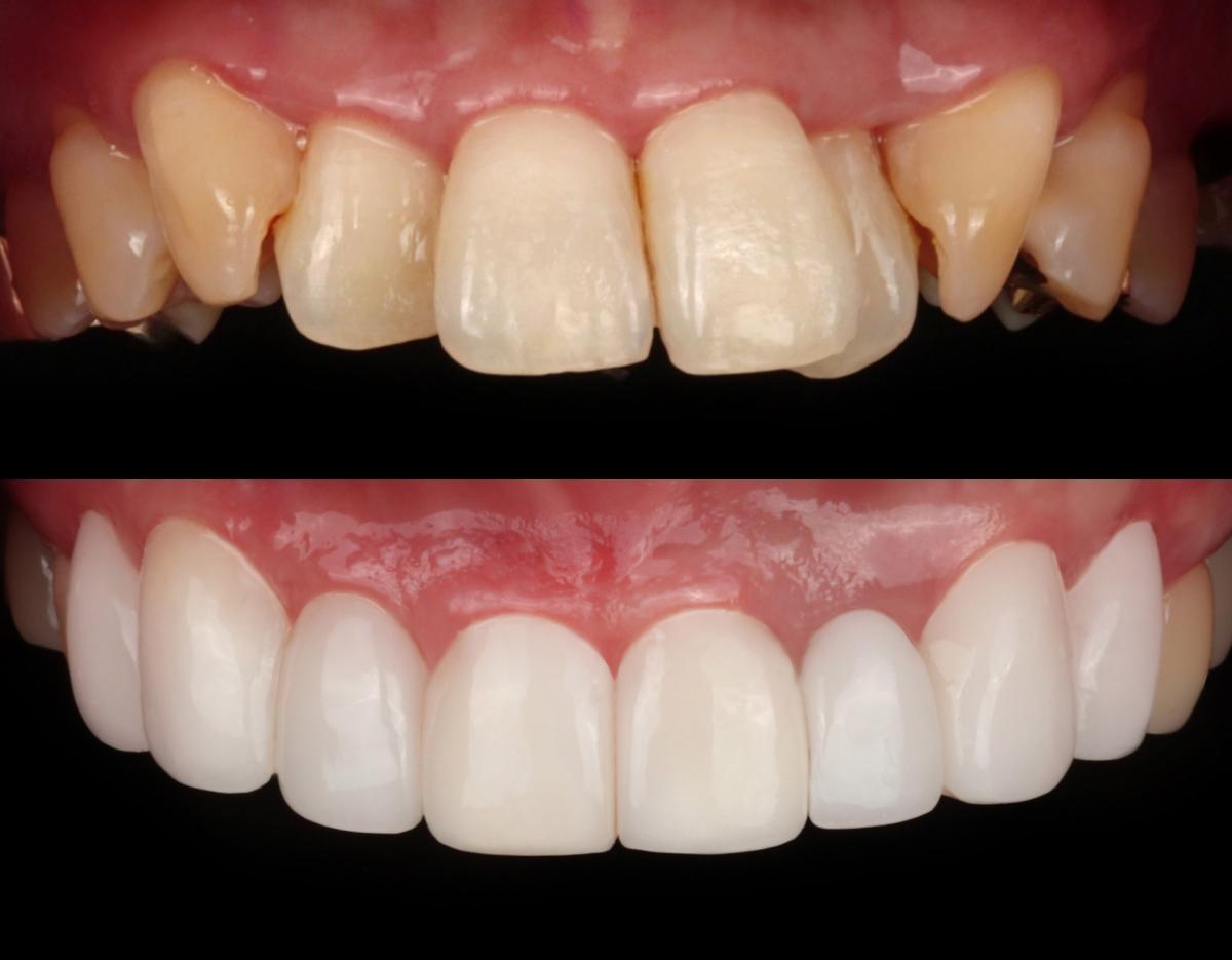 blanche dentalclinic