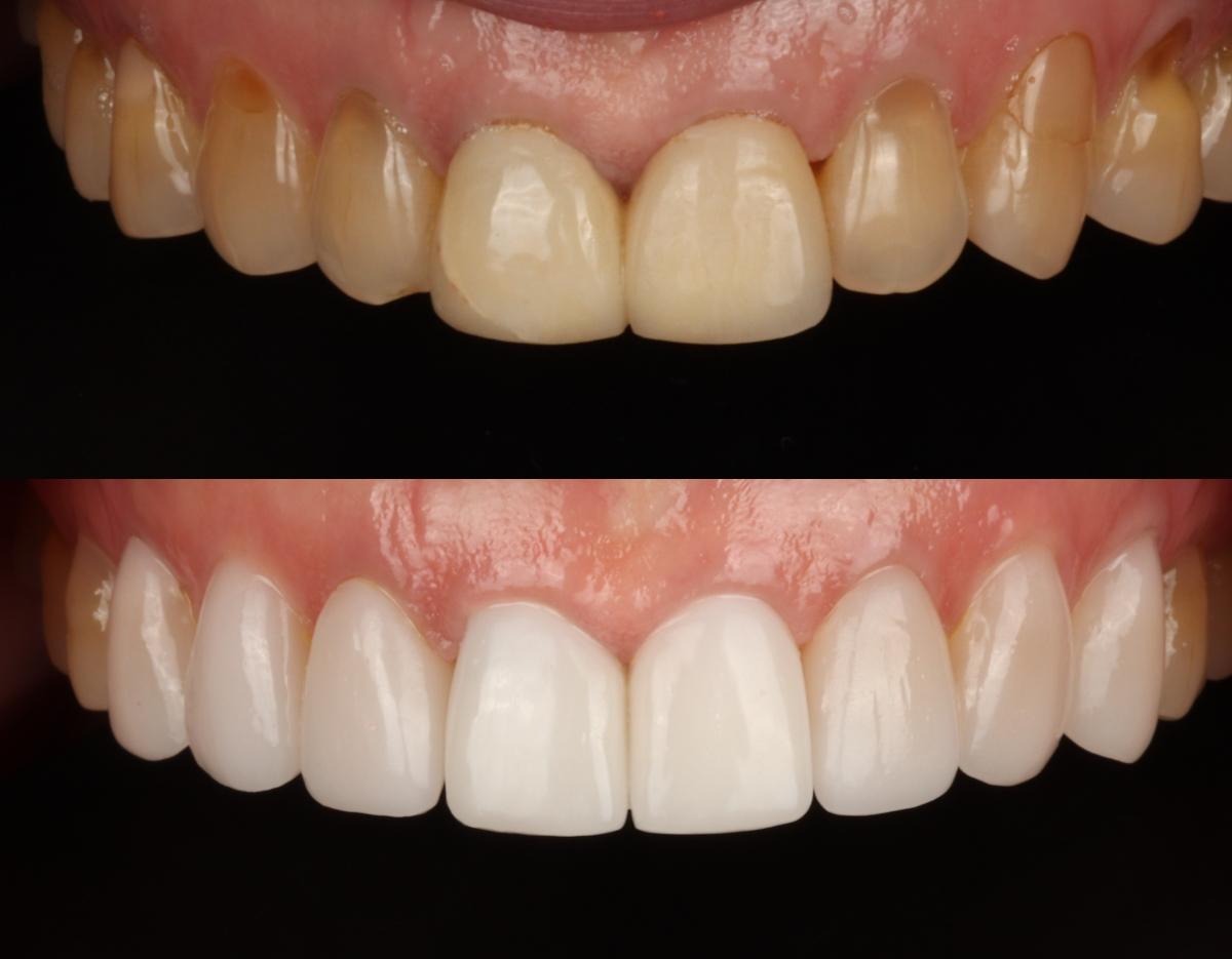 blanche dentalclinic