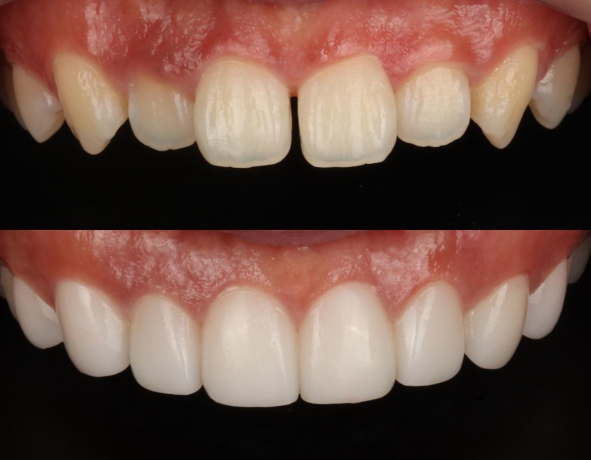 blanche dentalclinic