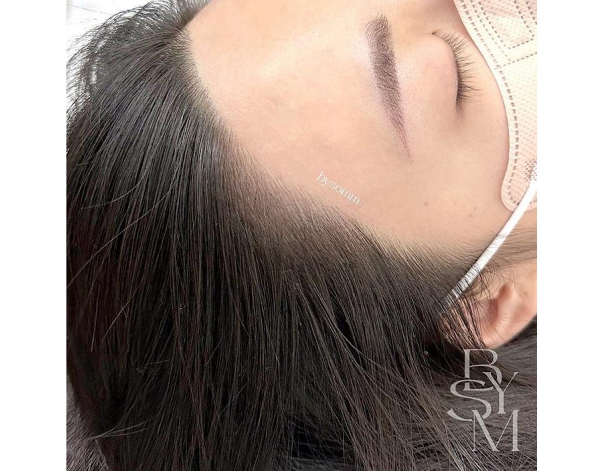 close-up of a client's hairline and shaved eyebrow area after hairline microblading, forehead and mask strap visible