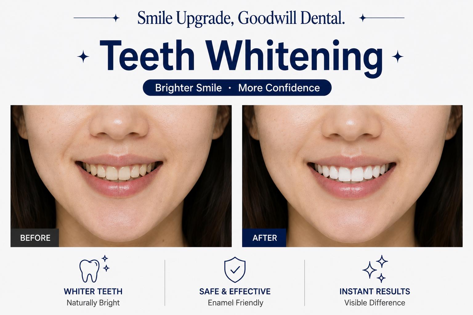 Before-and-after close-up of a patient's upper and lower teeth showing improved whiteness after Goodwill Dental whitening.