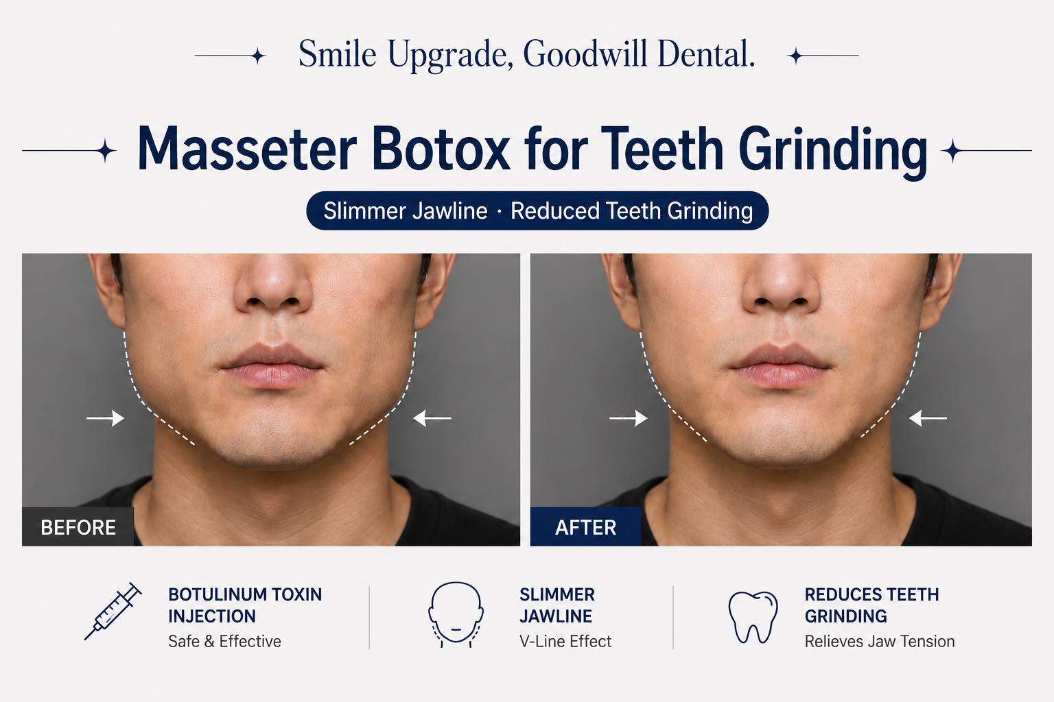 GOODWILL DENTAL HOSPITAL before-and-after oral photos showing upper and lower arches with metal fillings replaced and teeth visibly cleaned and restored