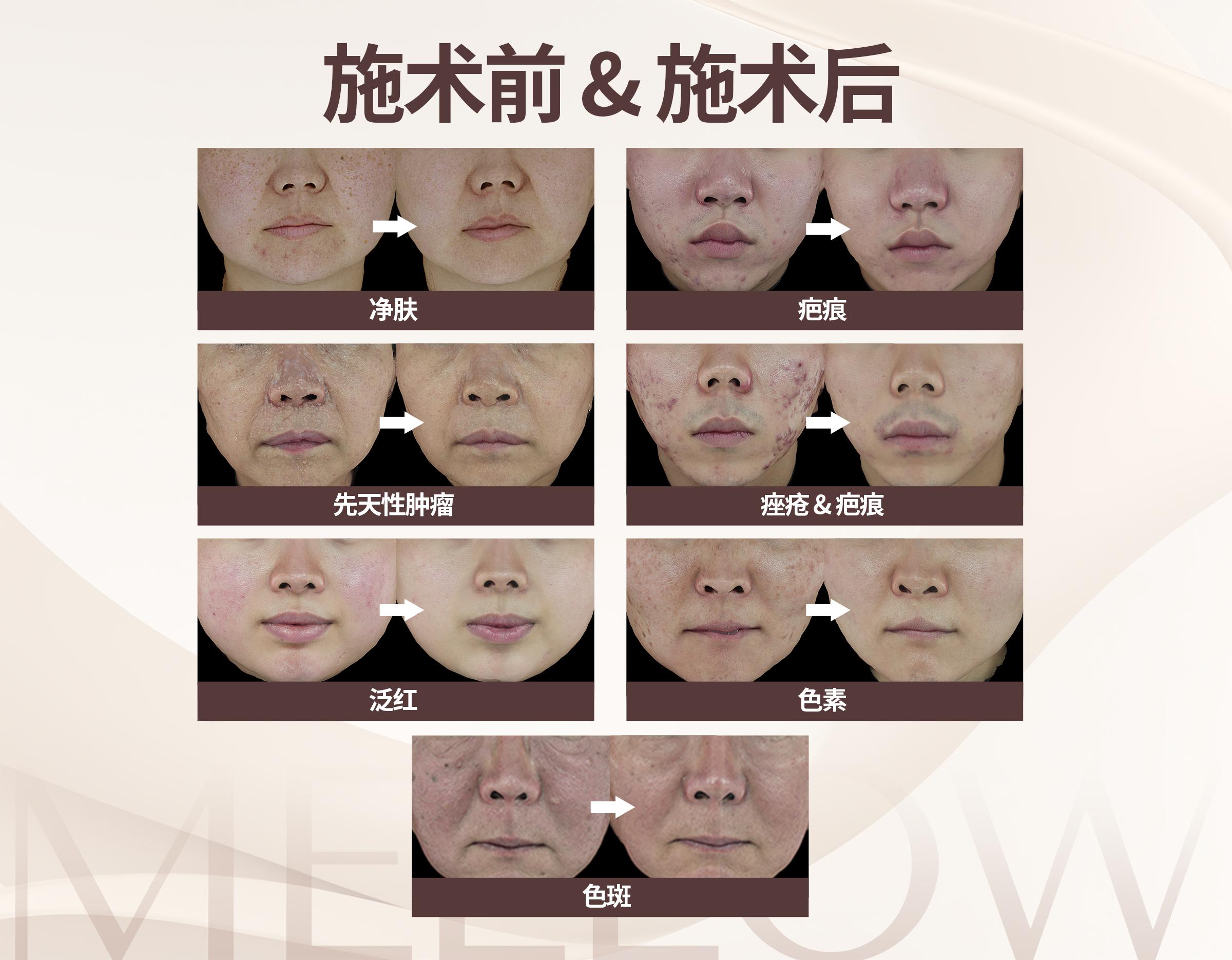 MELLOW CLINIC清潭店 | 韩国国家认证皮肤科专科医师 4