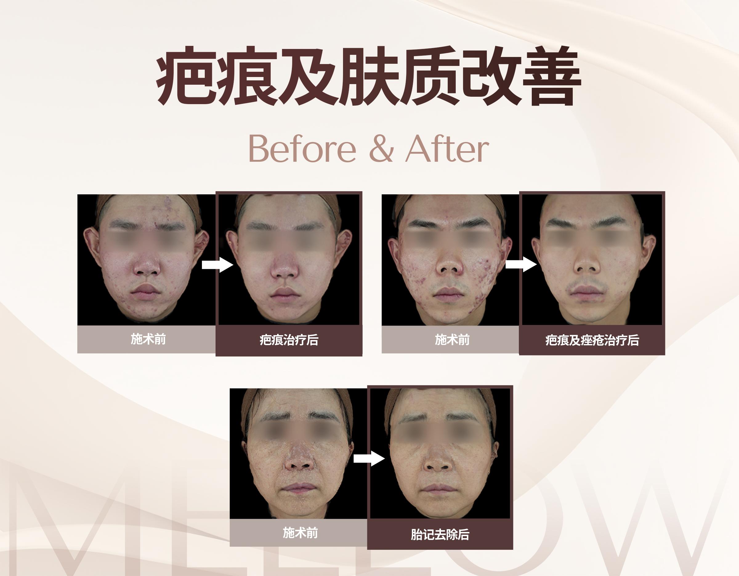 MELLOW CLINIC清潭店 | 韩国国家认证皮肤科专科医师 5