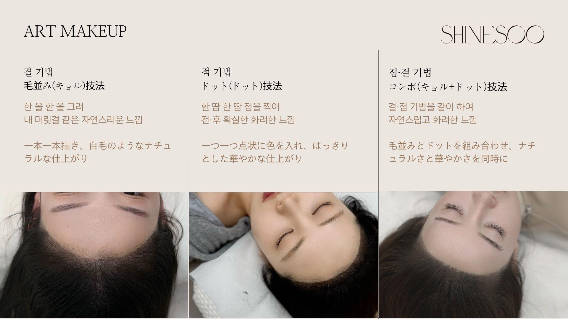 髮際線手法比較指引