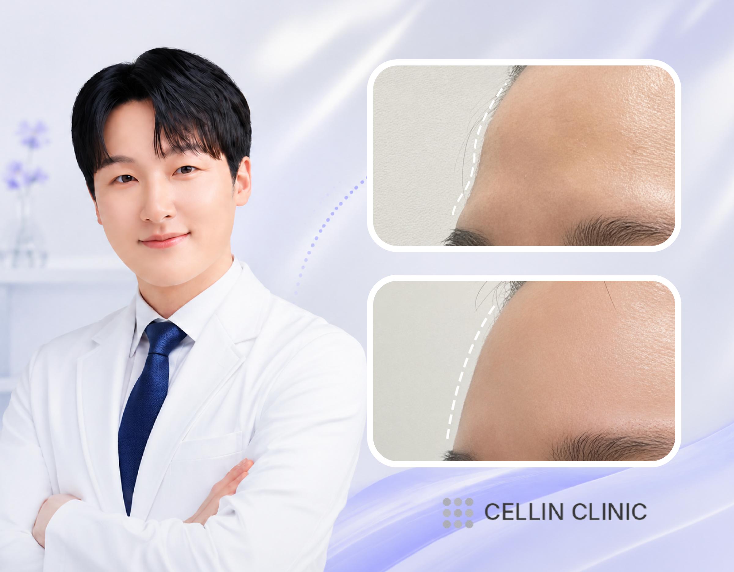 Cellin Clinic 明洞店 | 可提供外语咨询的明洞皮肤科 2