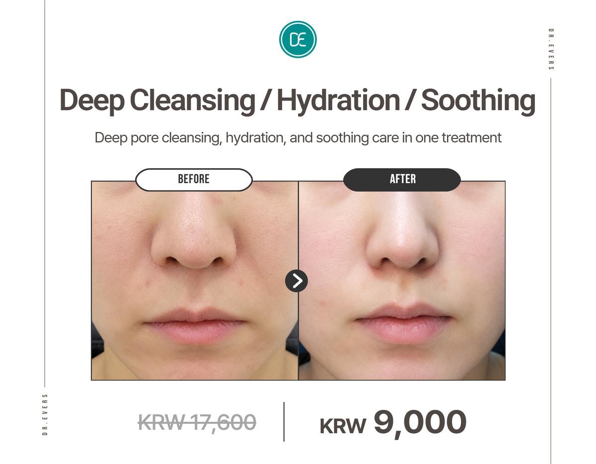 Dr. Evers Clinic Seomyeon before and after Deep Cleansing