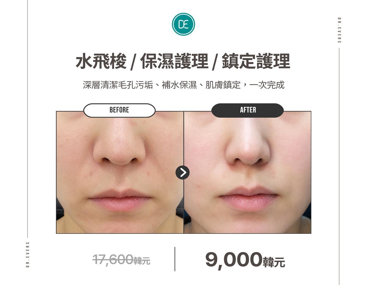 前後對比照 1