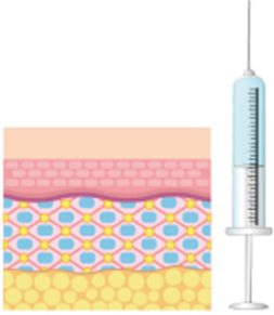 Image explaining how Skin Botox works