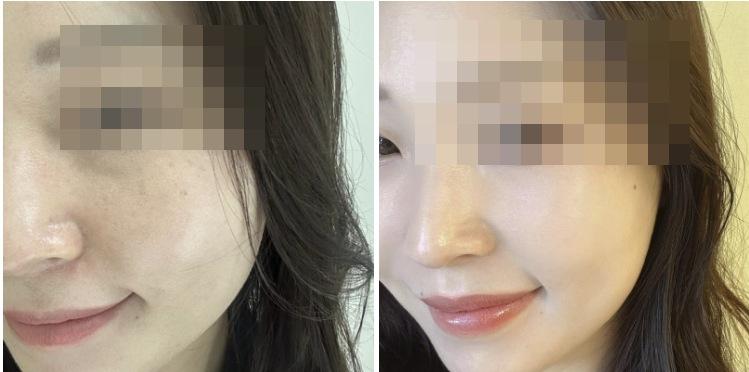 Re2O before and after photo
