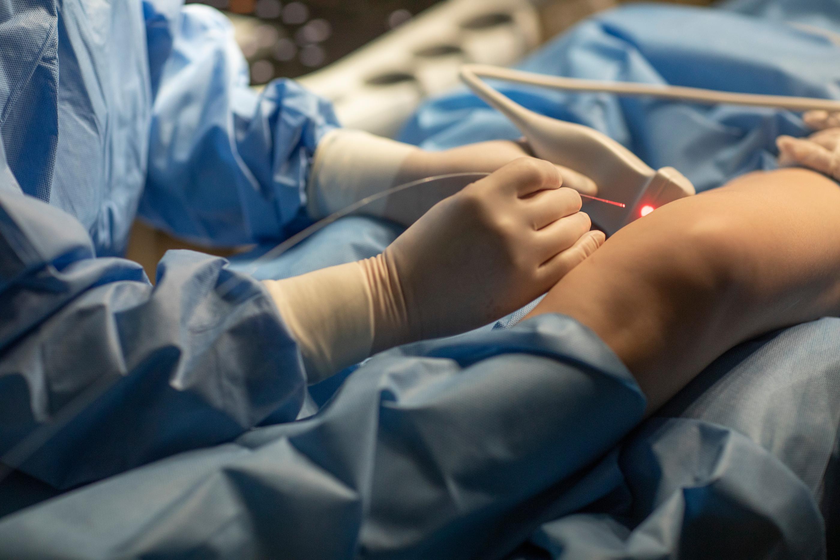 Laser Treatment (EVLT) procedure image