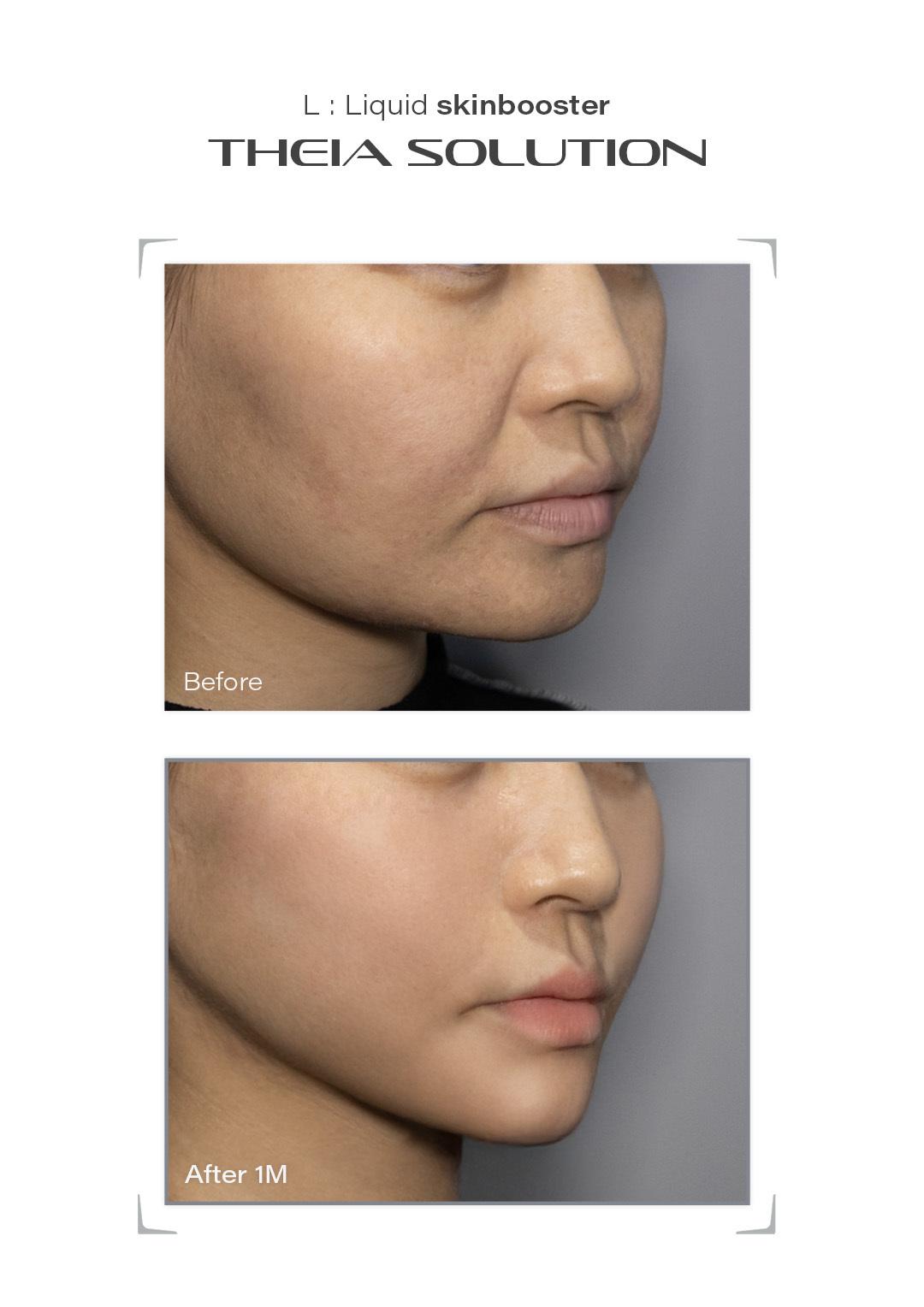 THEIA Solution before and after result example 17