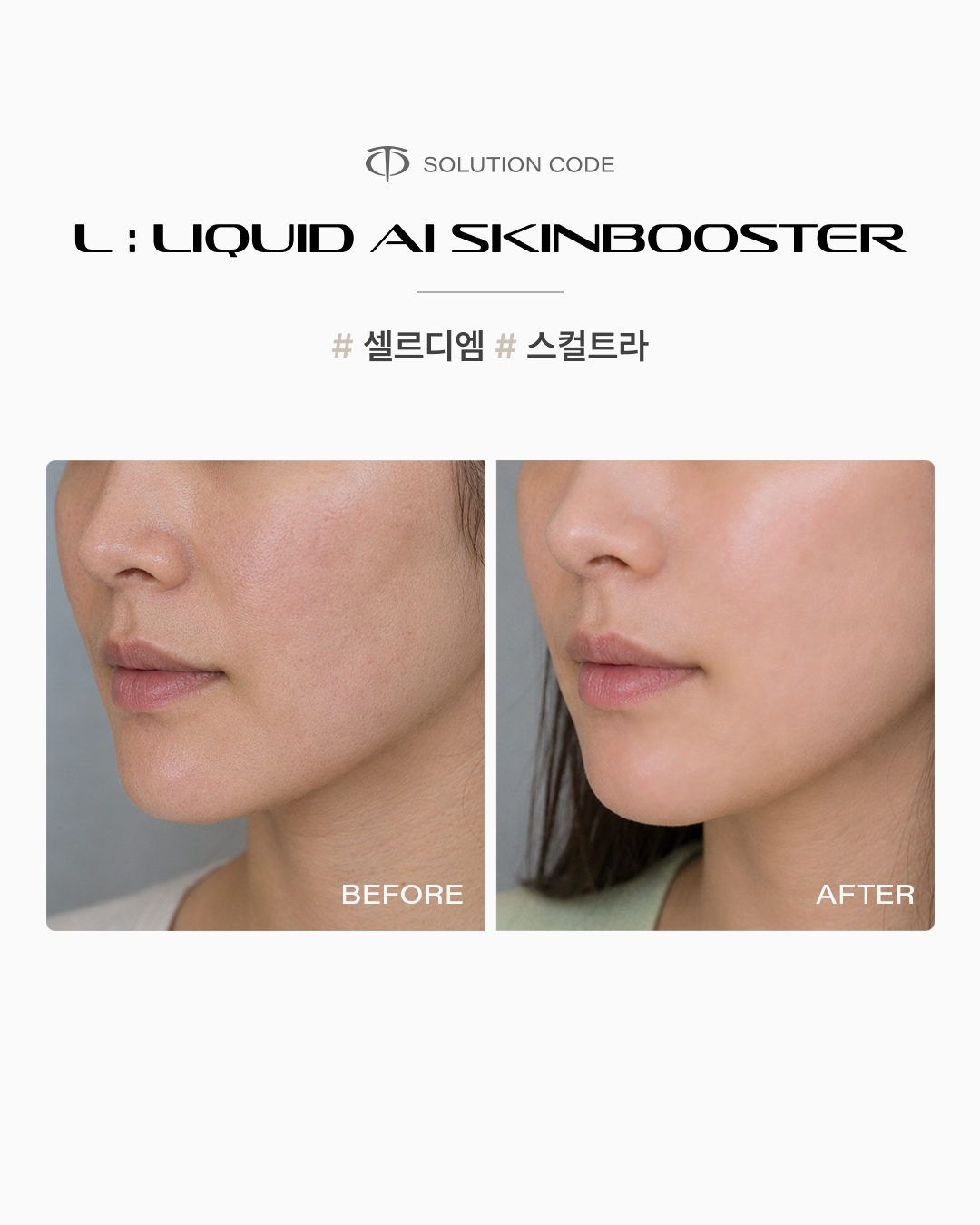 Contoh hasil sebelum dan sesudah perawatan Liquid AI Skin Booster