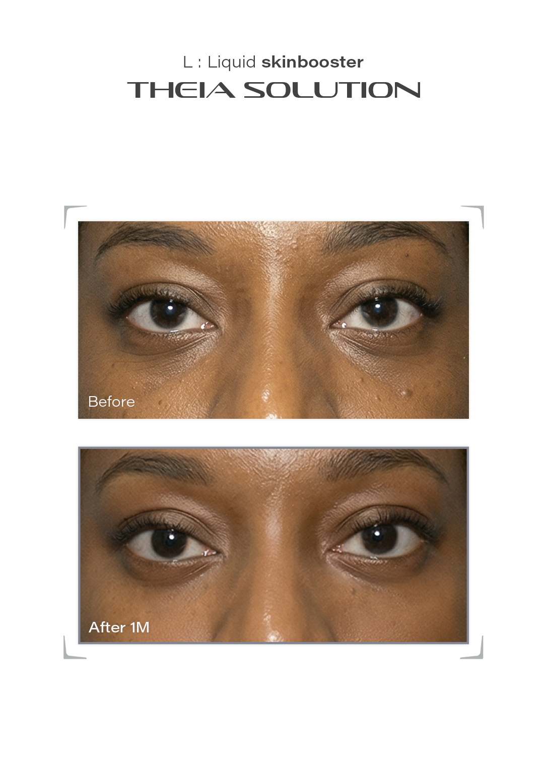THEIA Solution before and after result example 12