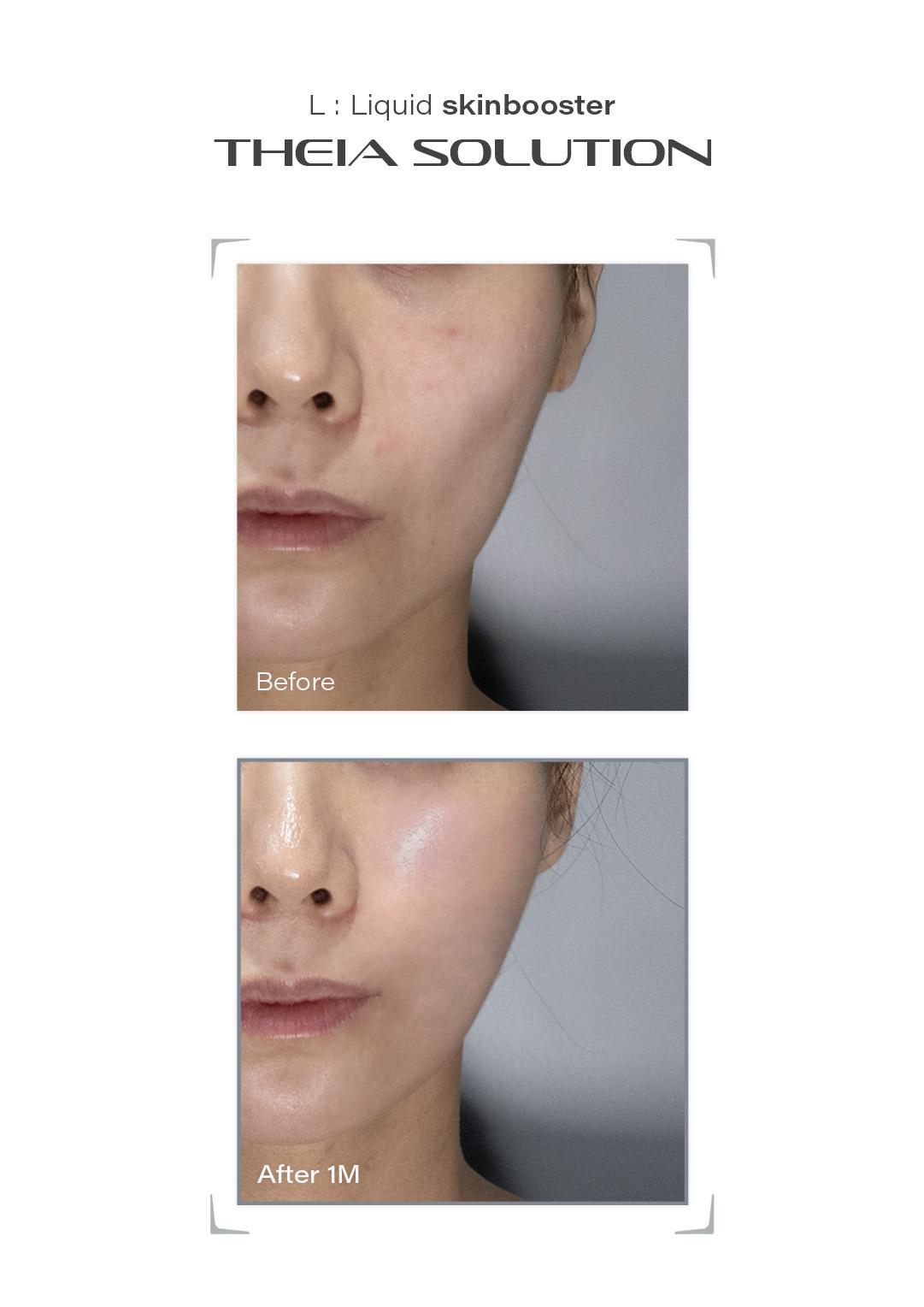THEIA Solution before and after result example 10
