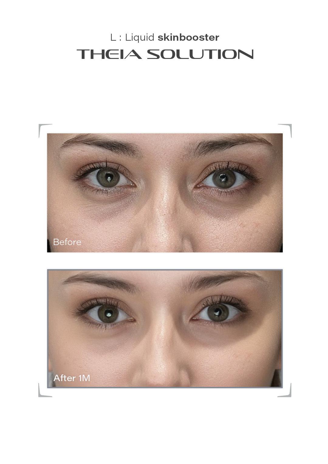 THEIA Solution before and after result example 14