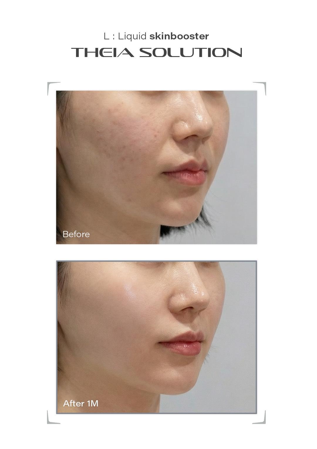 THEIA Solution before and after result example 16