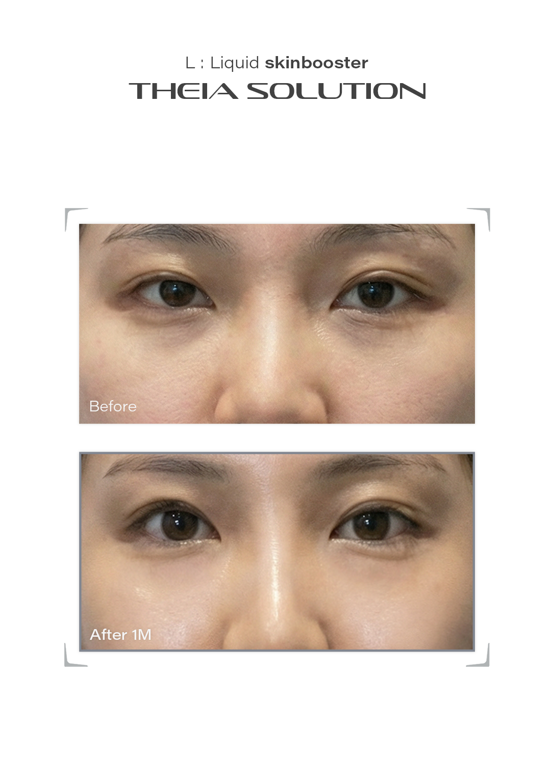 THEIA Solution before and after result example 13