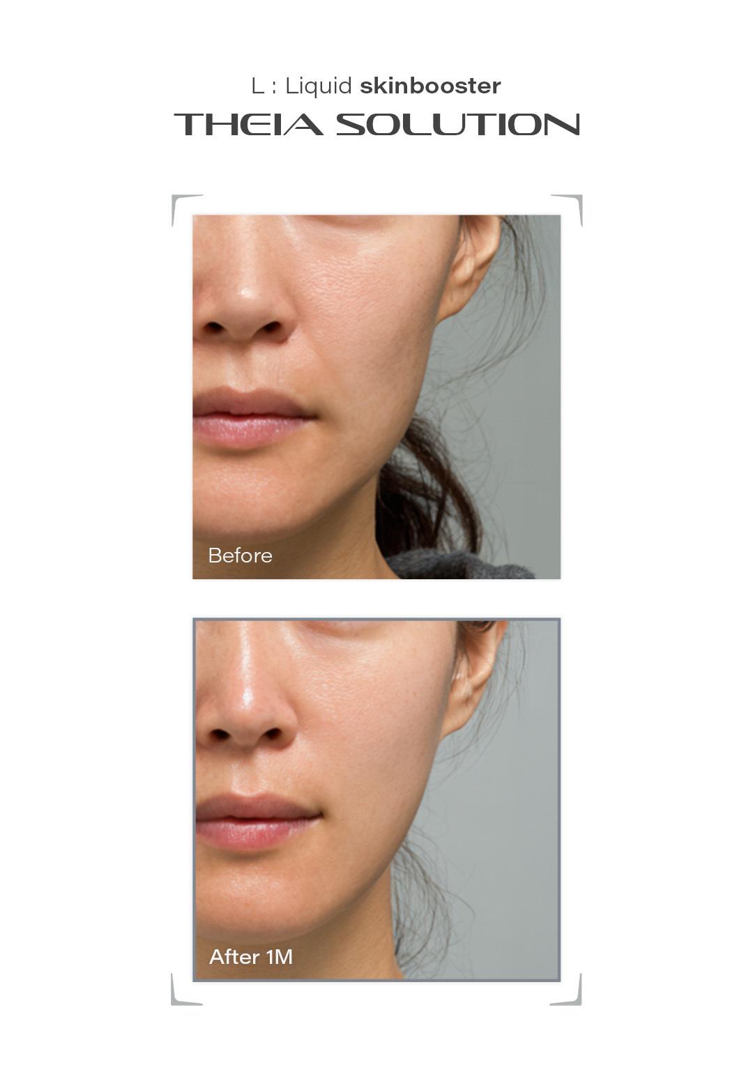 THEIA Solution before and after result example 18