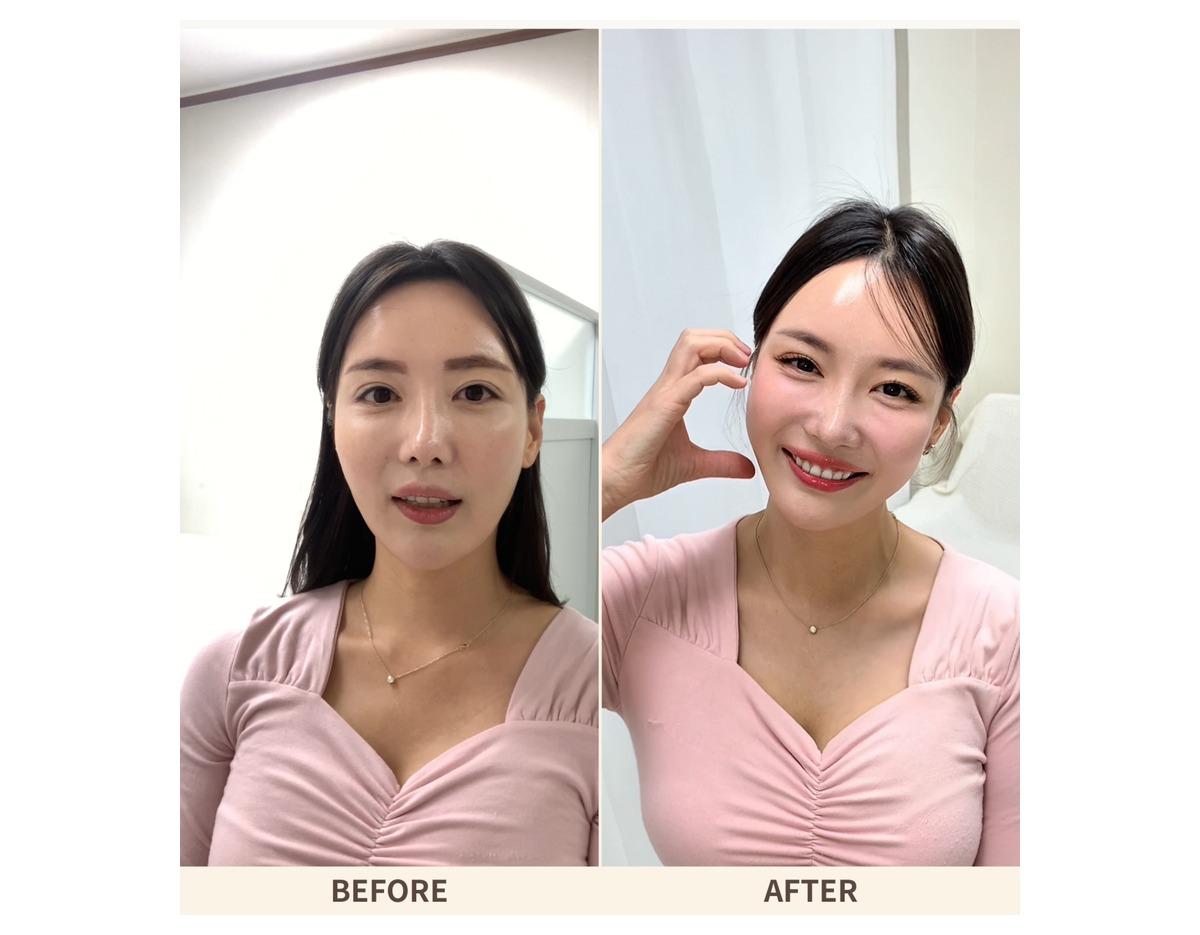 FIT SEE FIT SEE · ví dụ hình ảnh trước và sau 1