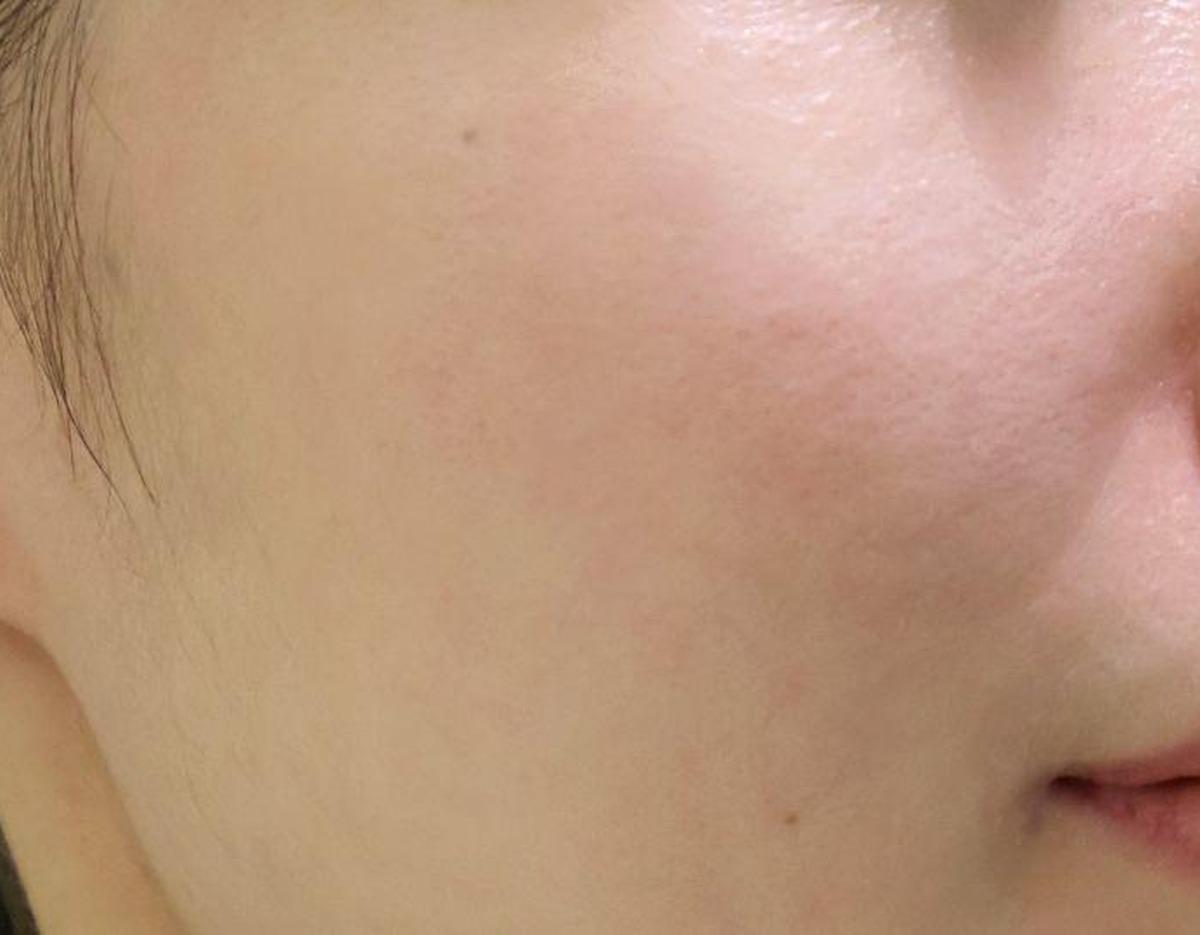 XENIA Clinic療程及院內環境圖片