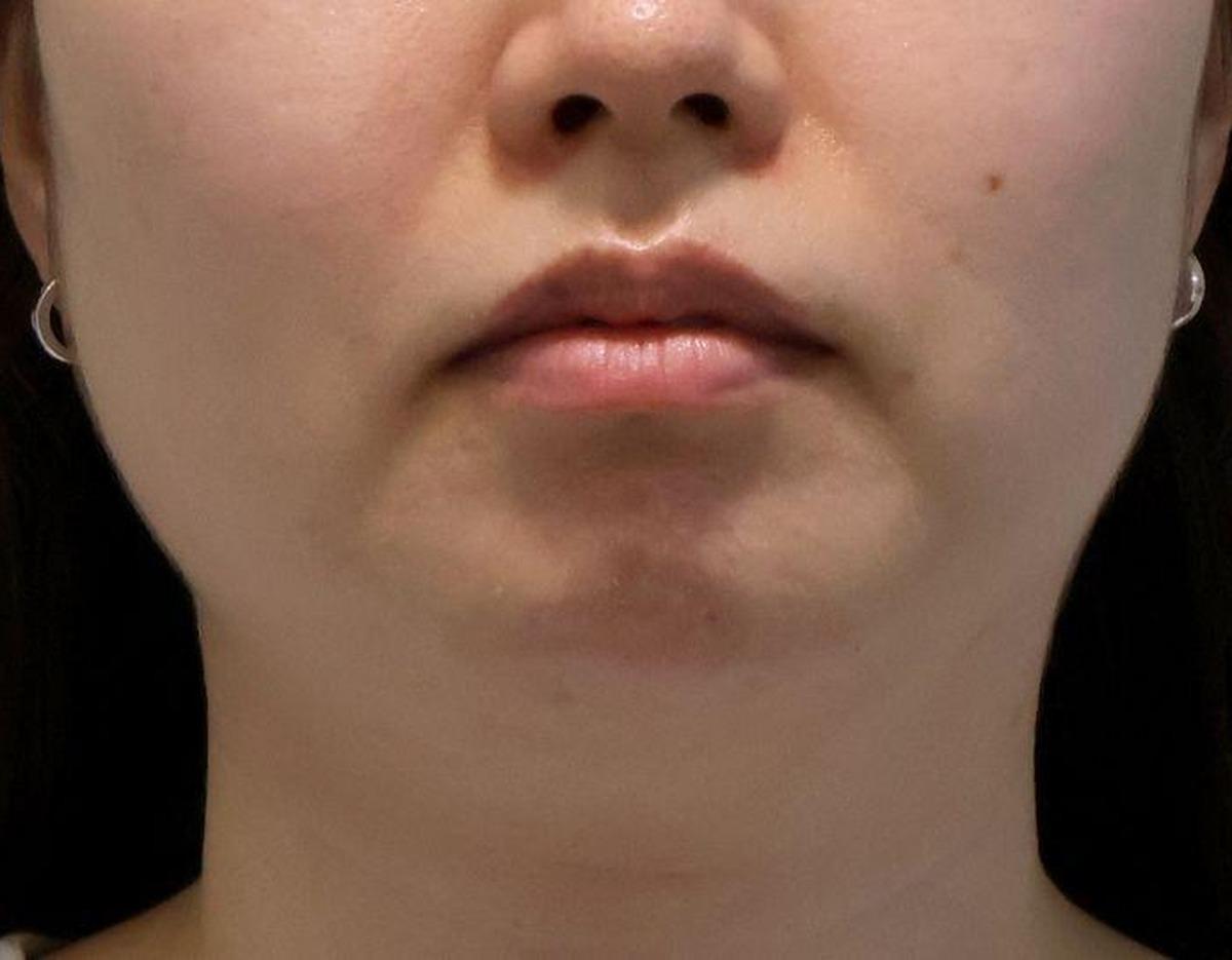 XENIA Clinic療程及院內環境圖片
