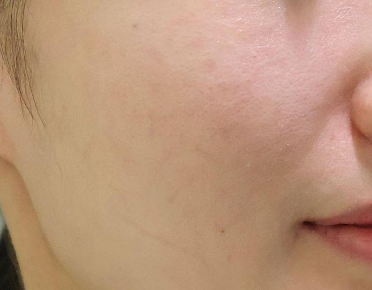 XENIA Clinic療程及院內環境圖片