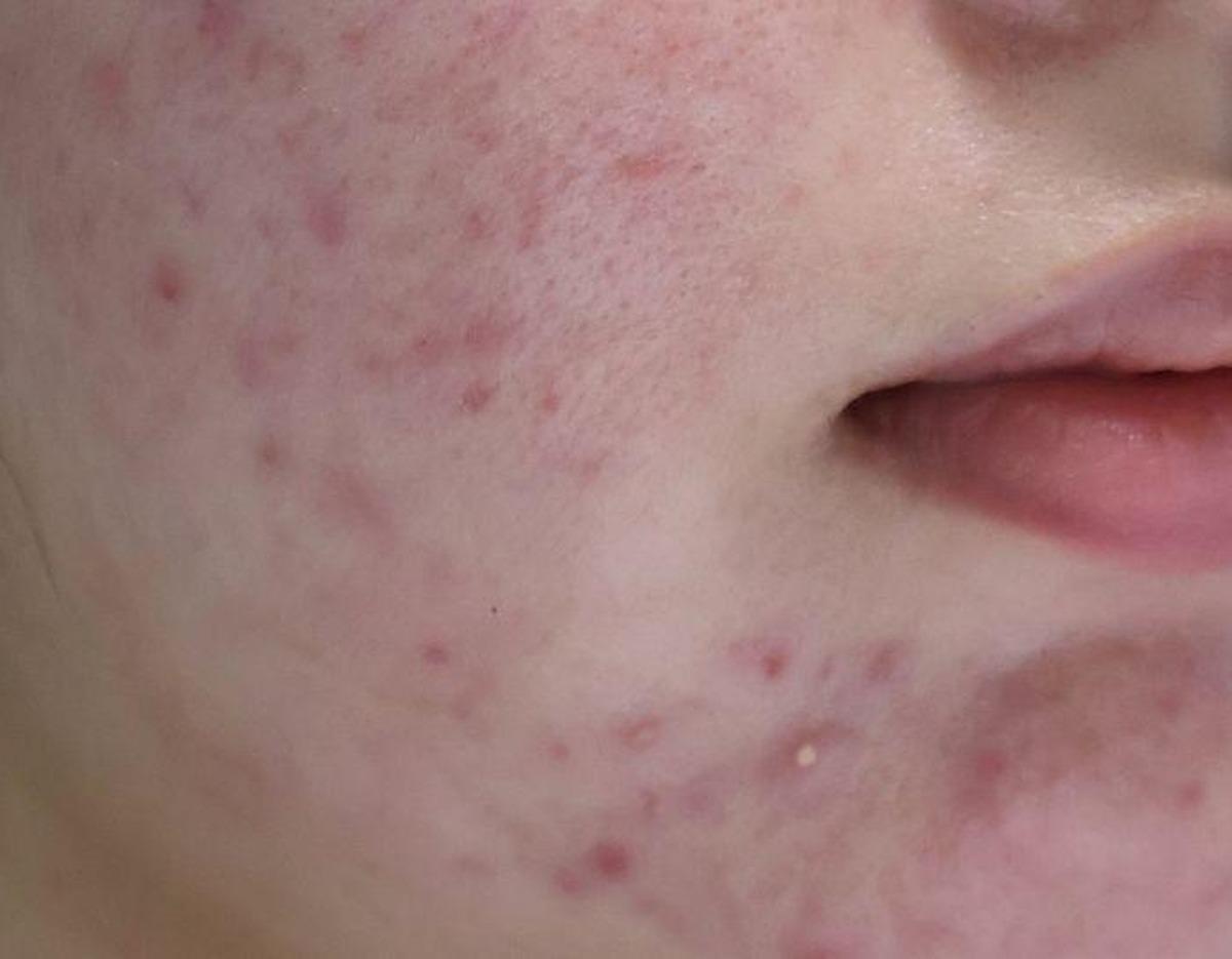 XENIA Clinic療程及院內環境圖片
