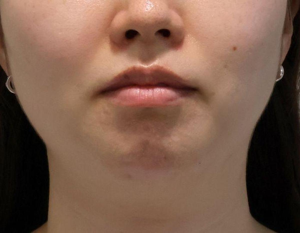 XENIA Clinic療程及院內環境圖片
