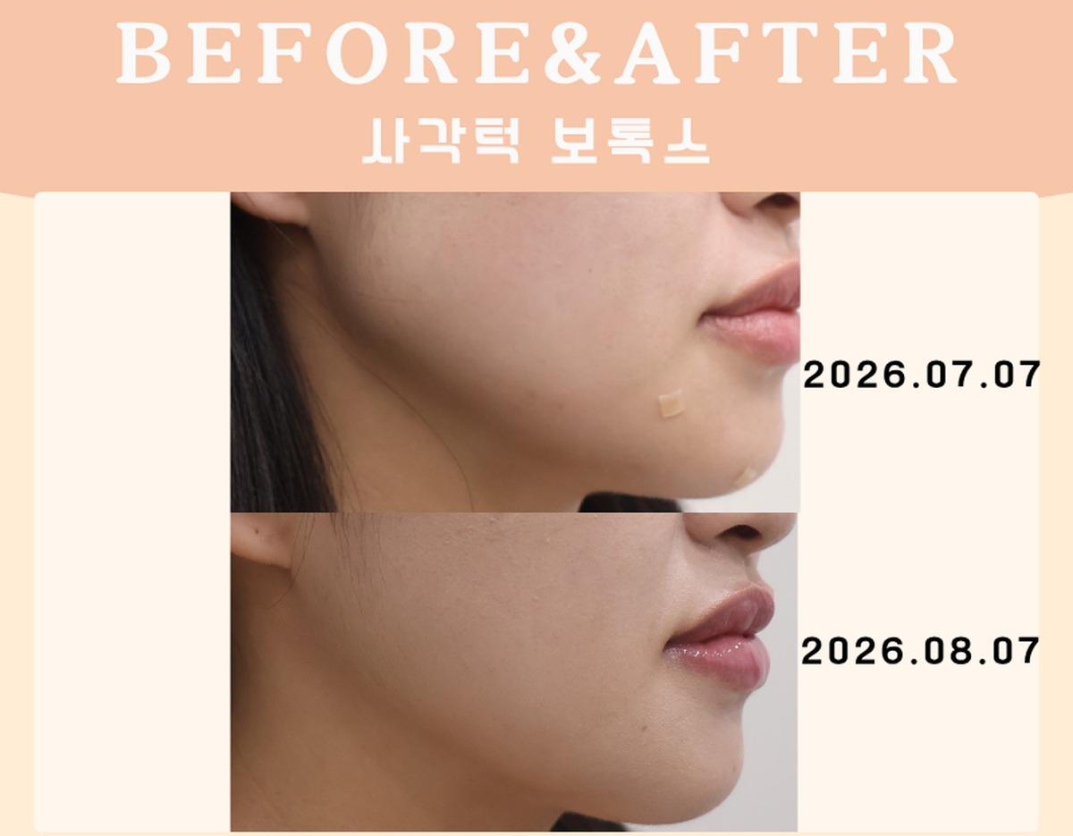 Before-and-after example