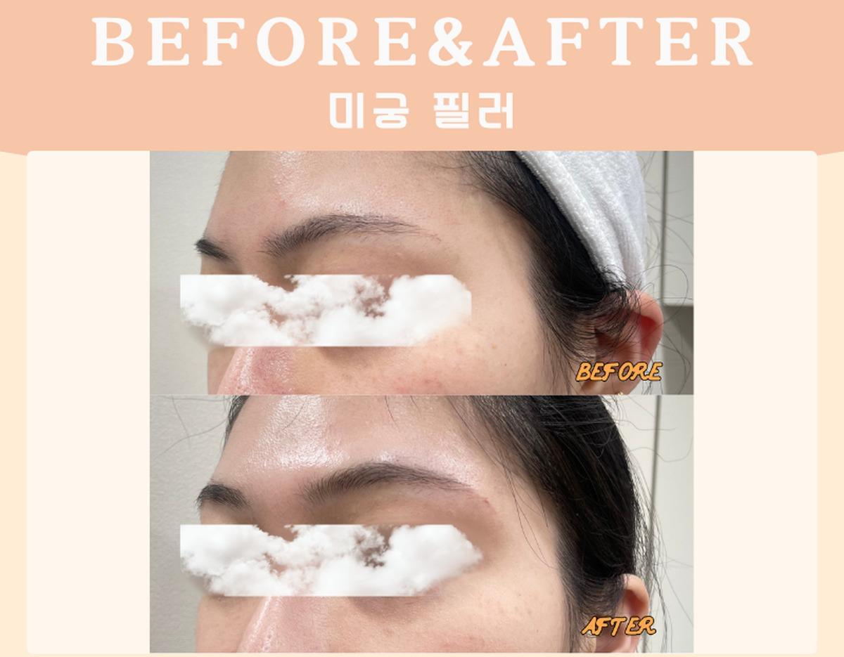 Before-and-after example