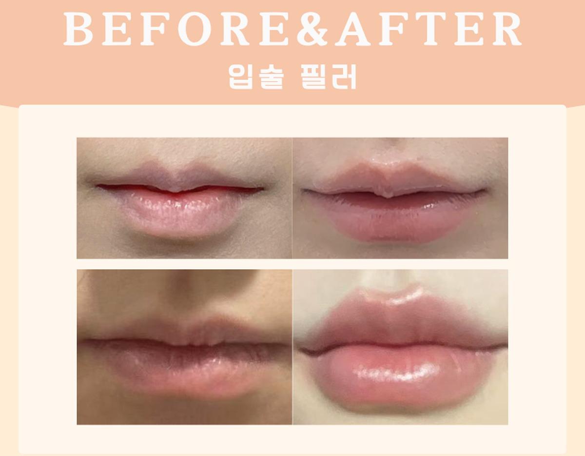Before-and-after example