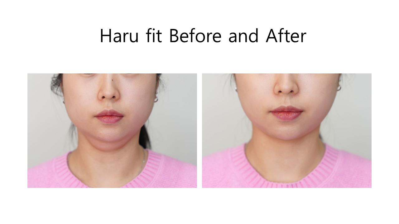 Haru fit before and after example