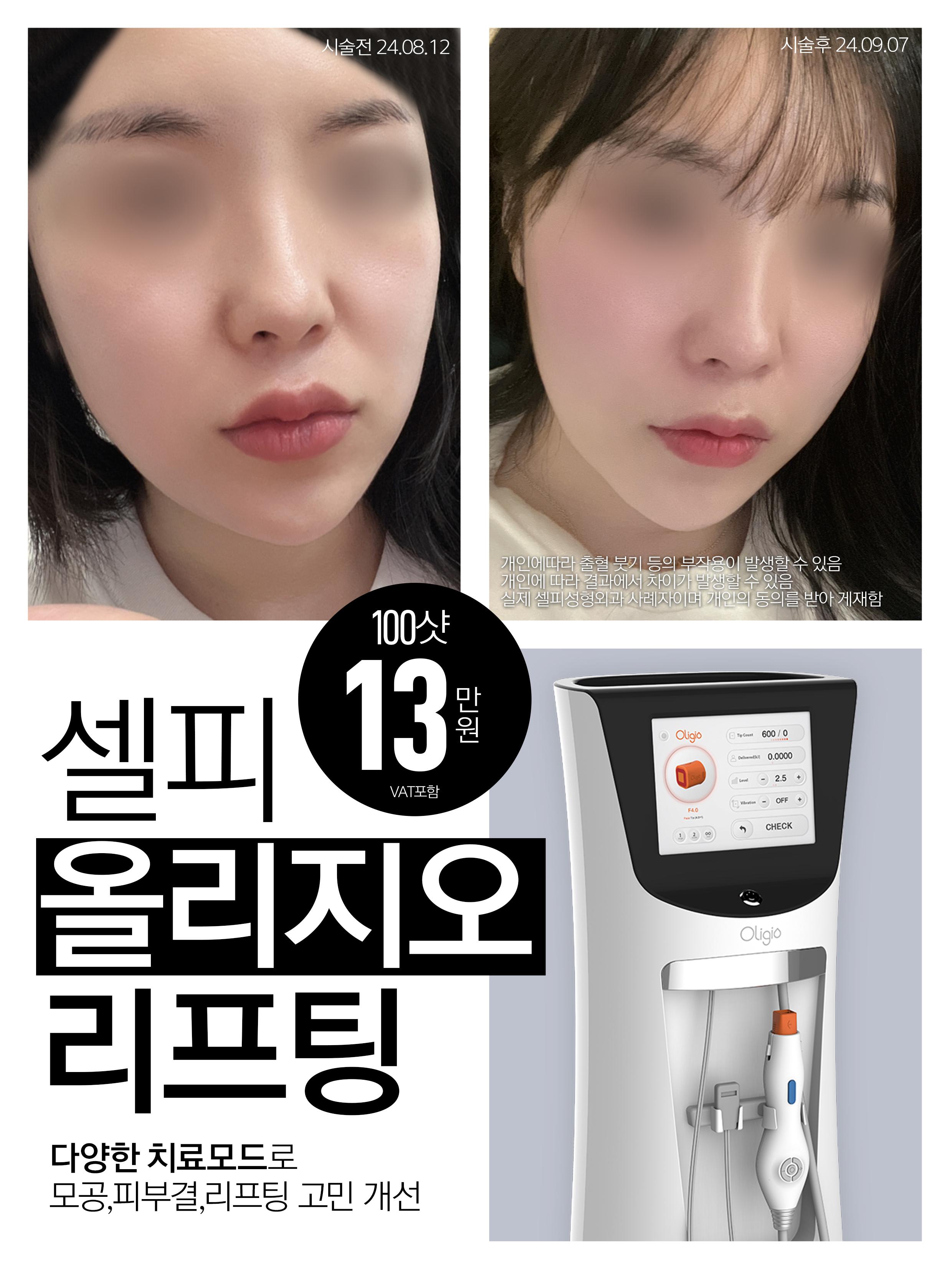 其他療程照片範例2