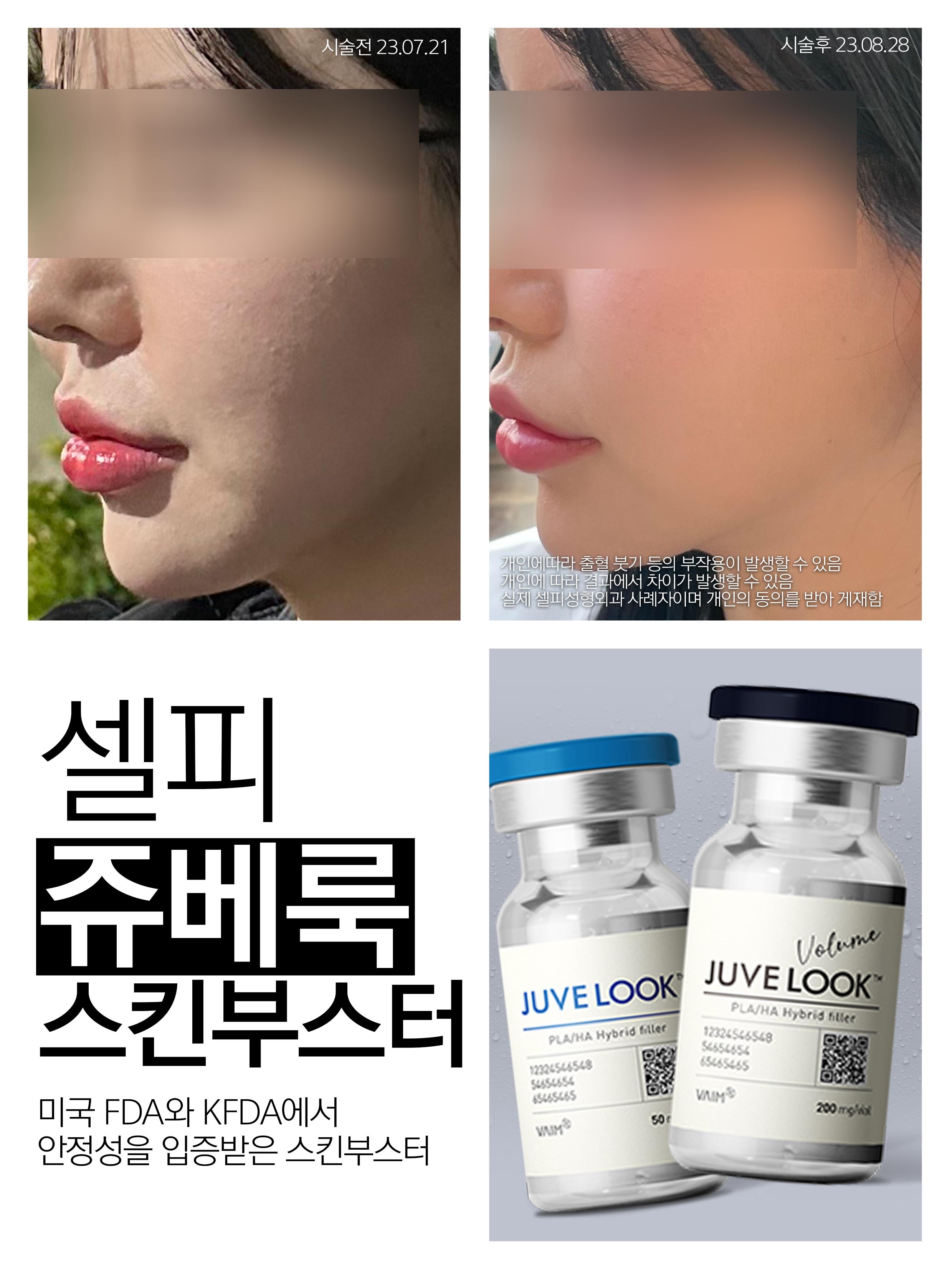 其他療程照片範例3