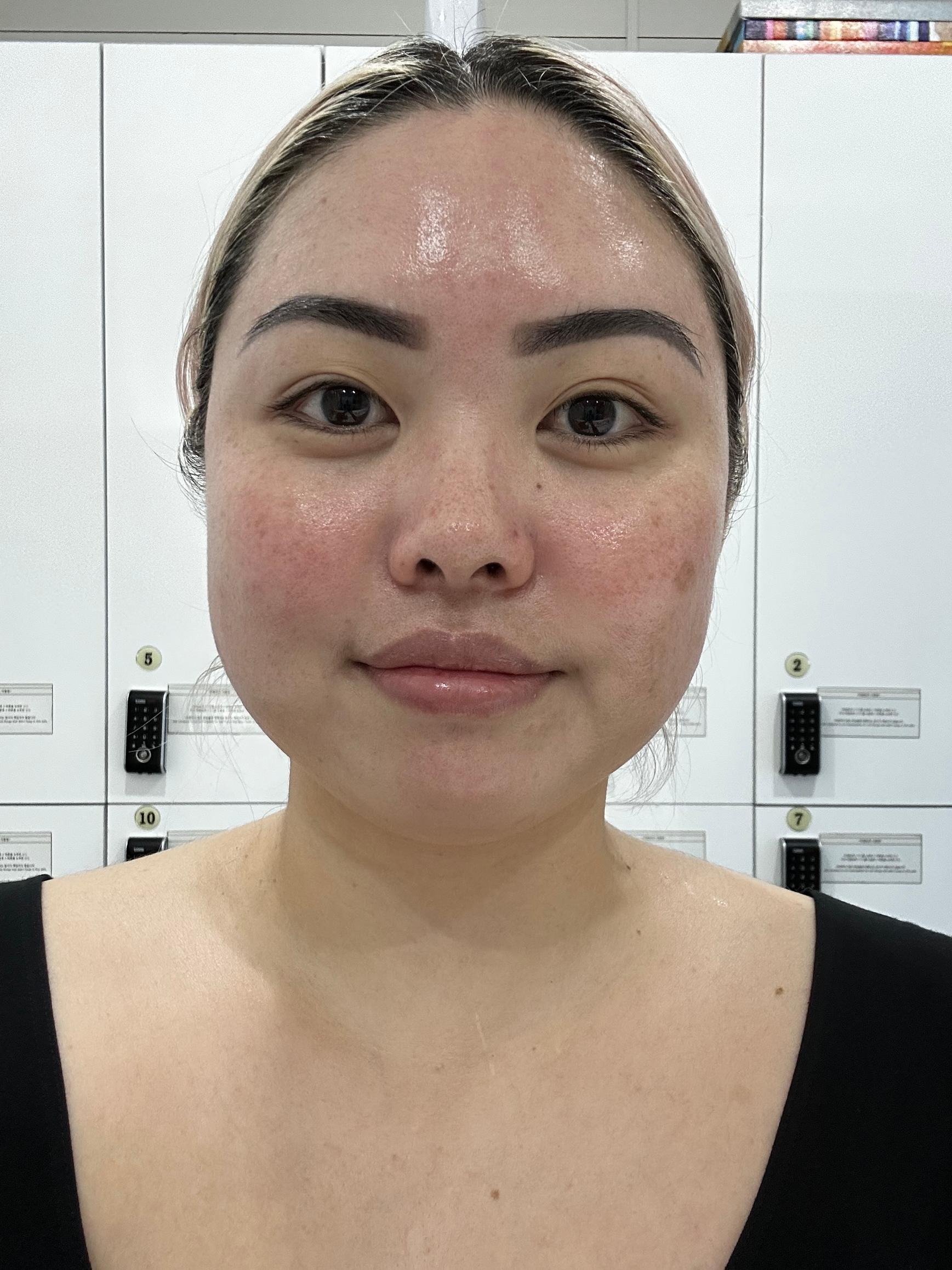K-Beauty Treatment at Medicube Clinic